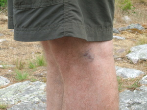 Appalachian Trail Bruse